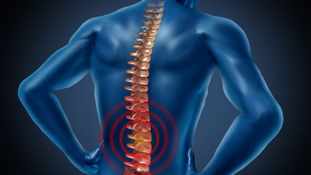 Back Pain: Could it be Spine Osteoarthritis?