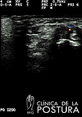 a73b51_08e8a6818fe855675da2f0fe6d30902b.png.webp