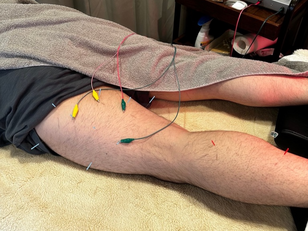 【『骨盤調整』のご紹介|体幹のねじれや骨盤のゆがみを改善し身体全体のバランスを整える】