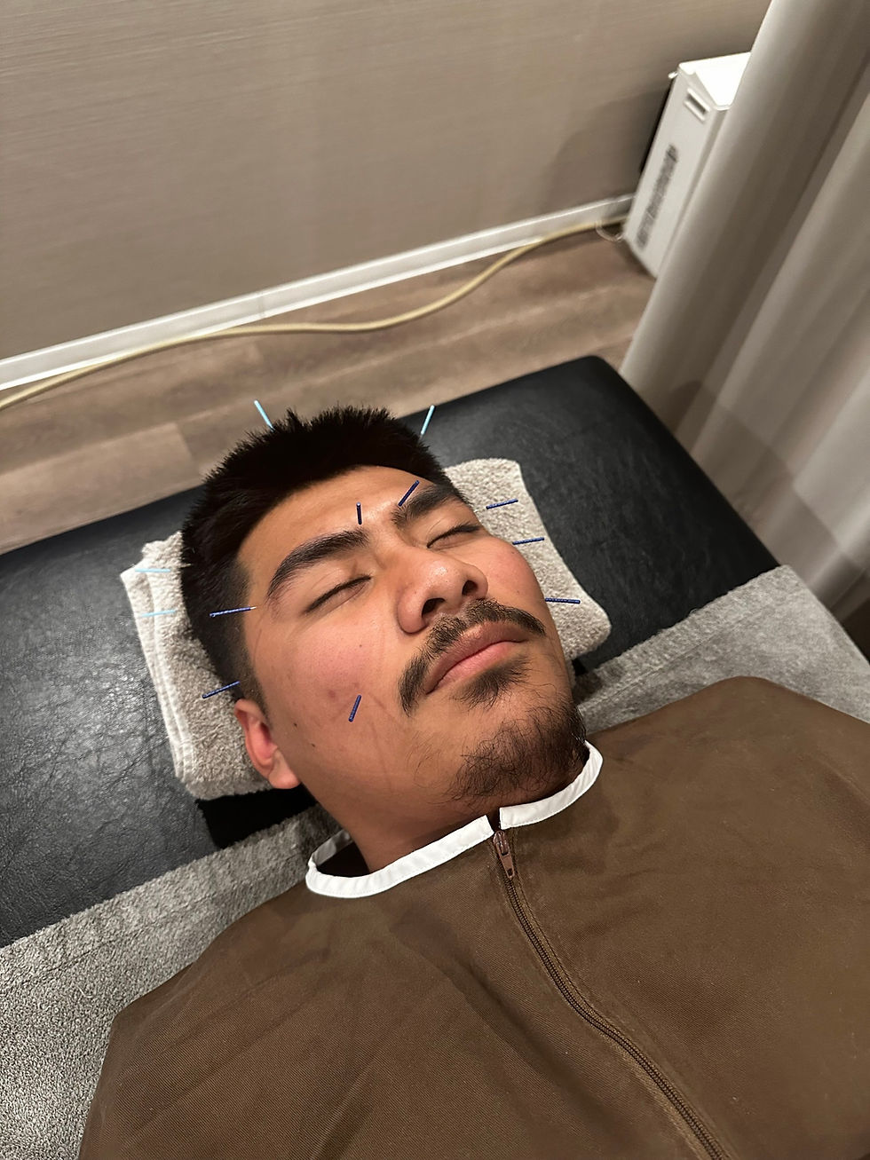 【Acupuncture for Travel Fatigue｜Treatment Report of a Guest from Alabama｜Roll Tide!】