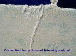 Calcium-Nodules__msi___jpeg (1)
