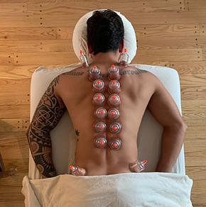 cupping.jpeg