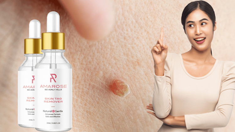 Amarose Skin Tag Remover.png