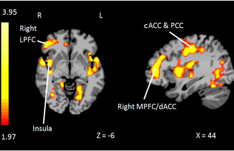 How Trauma Affects the Brain and How Cognitive Fitness Can Support Focus, Memory and Emotional Regulation