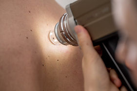 mole-checking-service.jpg