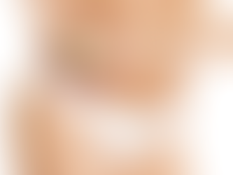 Do You Need Multiple Sessions for Laser Vaginal Tightening?
