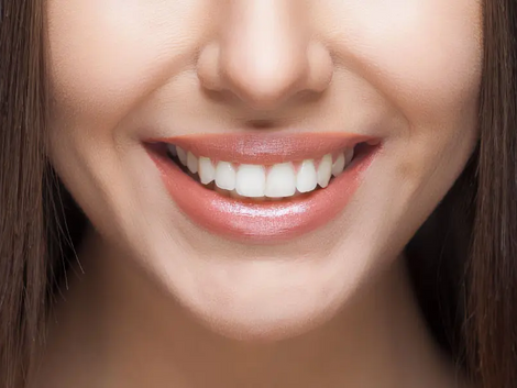 What Are the Innovations in Teeth Whitening Technology?