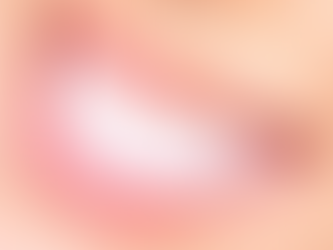 How Long Does Teeth Whitening Last for Users?
