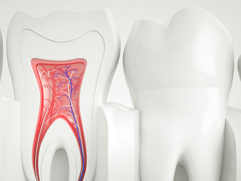 What Should You Expect After Root Canal Treatment?