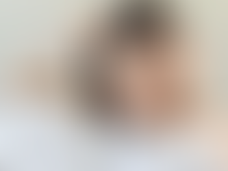 How to Choose the Right Hair Transplant for Women?