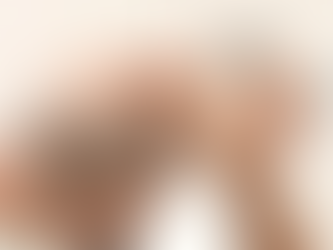 Crown Hair Transplant Surgery: A Comprehensive Guide
