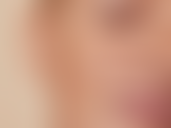 What Is the Science Behind the Best Birthmark Treatment?