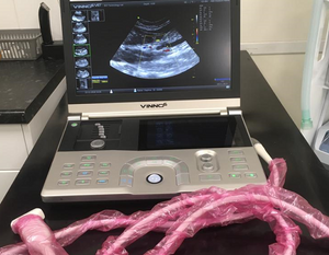 Amazing new ultrasound scanner