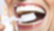 teeth whitening.jpg