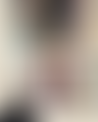 35歲女士 慢性濕疹 (By王愷喬醫師)