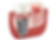 implant in gum.png