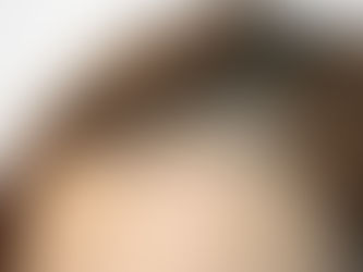 顔周りの短い髪の毛は切れ毛？頭皮が黄色信号です。