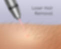 realistic-illustration-laser-hair-removal-legs_212889-5342.jpg