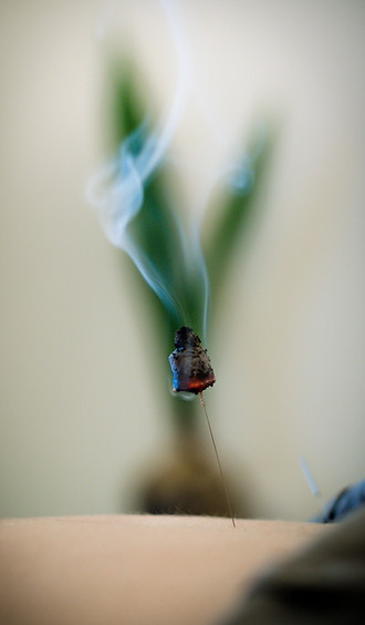 גילי אטקין-רפואה סינית