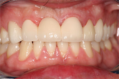 Patient 4 After