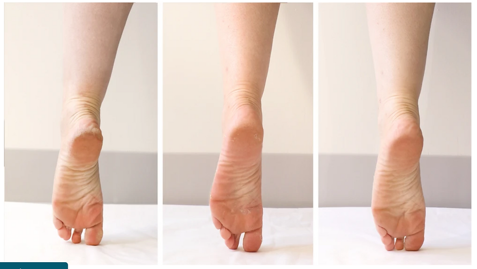 Thumbnail: PoshPeel™ Pedi Cure
