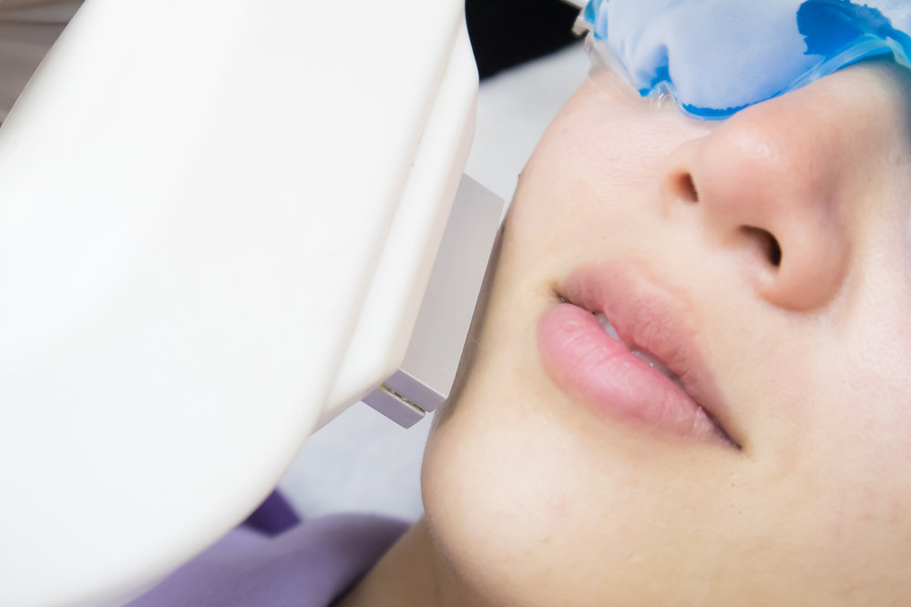 Ipl laser during pregnancy clearance