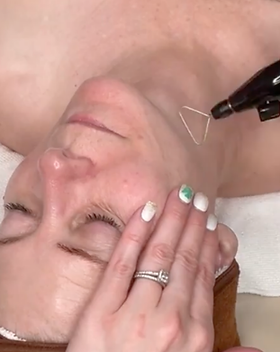 PlasmaChanneling picture.png