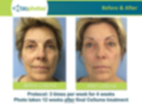 CELLUMA ANTI AGEING.jpeg