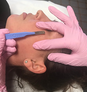 dermaplaning3.jpeg