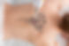 Tattoo removal.jpg