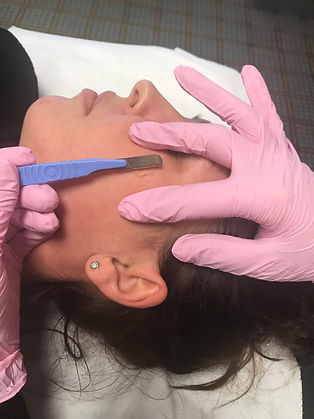 dermaplaning3.jpeg