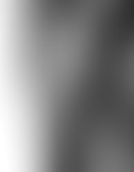 Knee arthritis? Exercise can help manage the pain