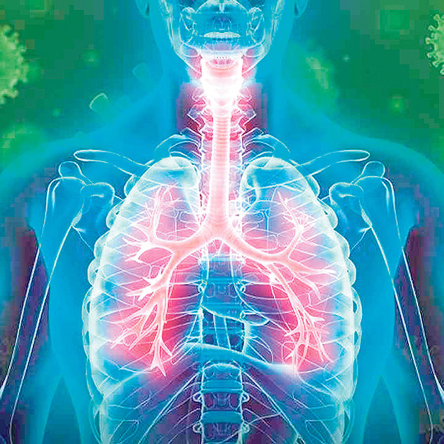 Pruebas dirigidas a virus pueden pasar por alto patógenos bacterianos respiratorios asociados a neumonía