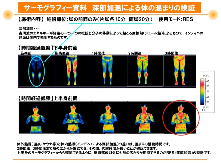 インディバ 温活