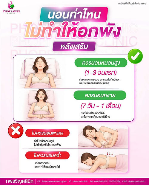 ท่านอนที่ถูกต้องหลังเสริมหน้าอกเพื่อป้องกันหน้าอกเสียทรง