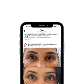 Quem recomenda (1).png