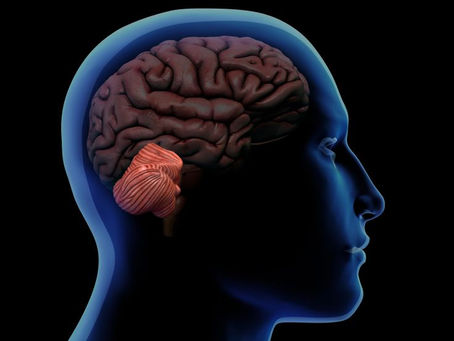 Cerebellum is a disorder that occurs when the cerebellum becomes inflamed