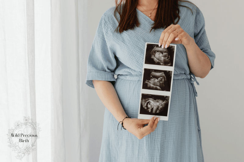 Pregnant woman in a light blue dress stands by a bright window holding a strip of three ultrasound images in front of her baby bump. The photo represents the anticipation and preparation that comes before becoming a first-time mom.