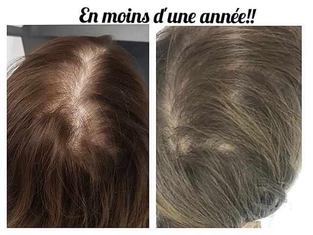 Résultat