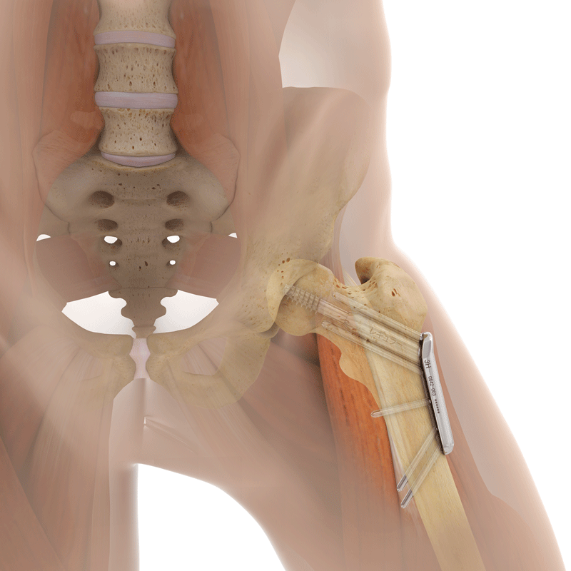 Fig_3Revision1022.gif