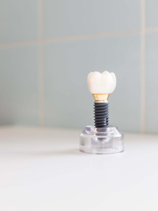 dental implants model
natural teeth
dental implant treatments
oral health
number of implants
dental clinic
initial consultation
implantation surgery
implants cost in turkey
cost of dental
removable dentures
dental bridge
varies depending
healing period
affordable prices
bone density
attached to the implants
on-4 dental implants
tooth replacement
prices in turkey
dental implant surgeries dental implant cost
all on 4 dental implants
dental implants turkey
dental implants and prices
dental implants implants
dental implants turkey cost