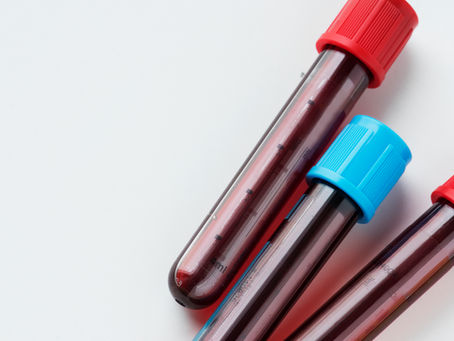 Ferritina: como estão suas reservas de ferro no sangue?