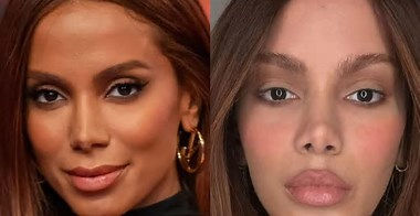 Anitta, antes e depois - Reprodução