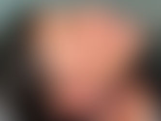 Promoter David Santiago se submete a cirurgia estética facial com o especialista Dr. Patrick Peloso