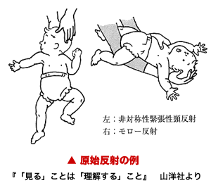原始反射の例