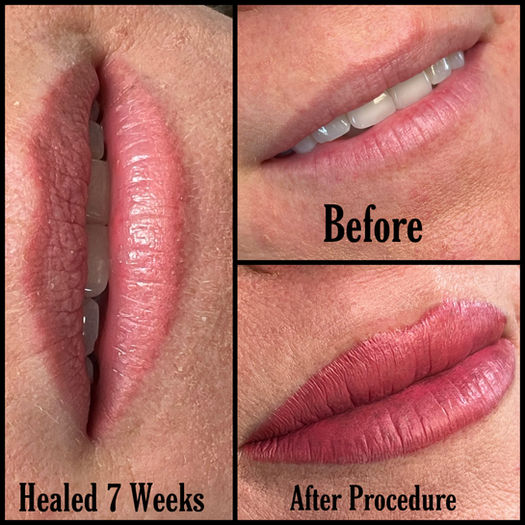 Close-up of healed lip blush, illustrating the technique's ability to create a soft, natural look