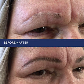 Before-and-after of a brow touch-up session, refining shape and color for long-lasting, even results.
