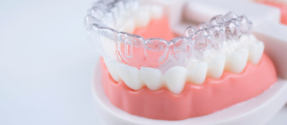 Using Miniature 6-axis F/T Sensor for Orthodontic Research