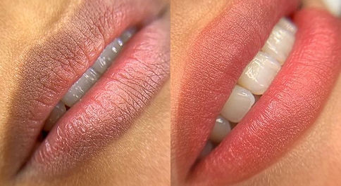 dark lip neutralisation