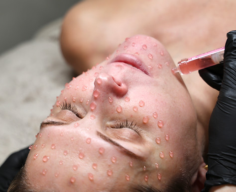 salmon sperm facial